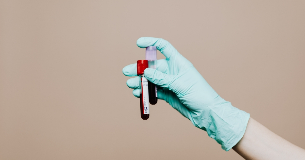 blood-test